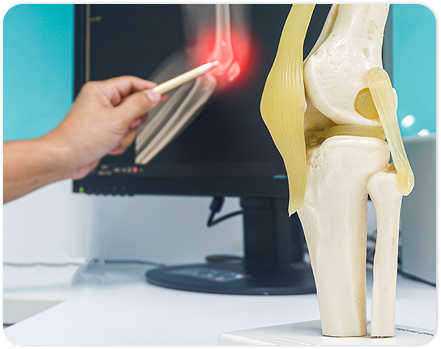 Renova Institute of Neurological Sciences (RINS) – Best Neurologists in Hyderabad